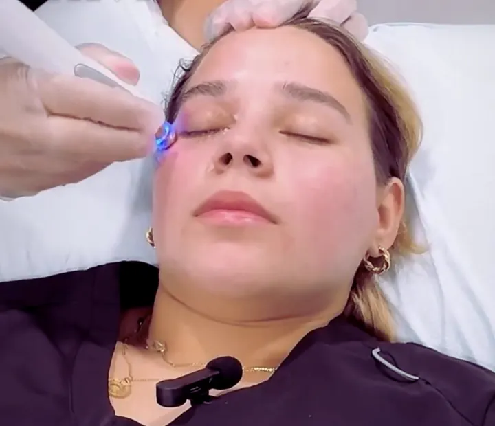 Calibrated pulse light treatment being performed near a patient's eye