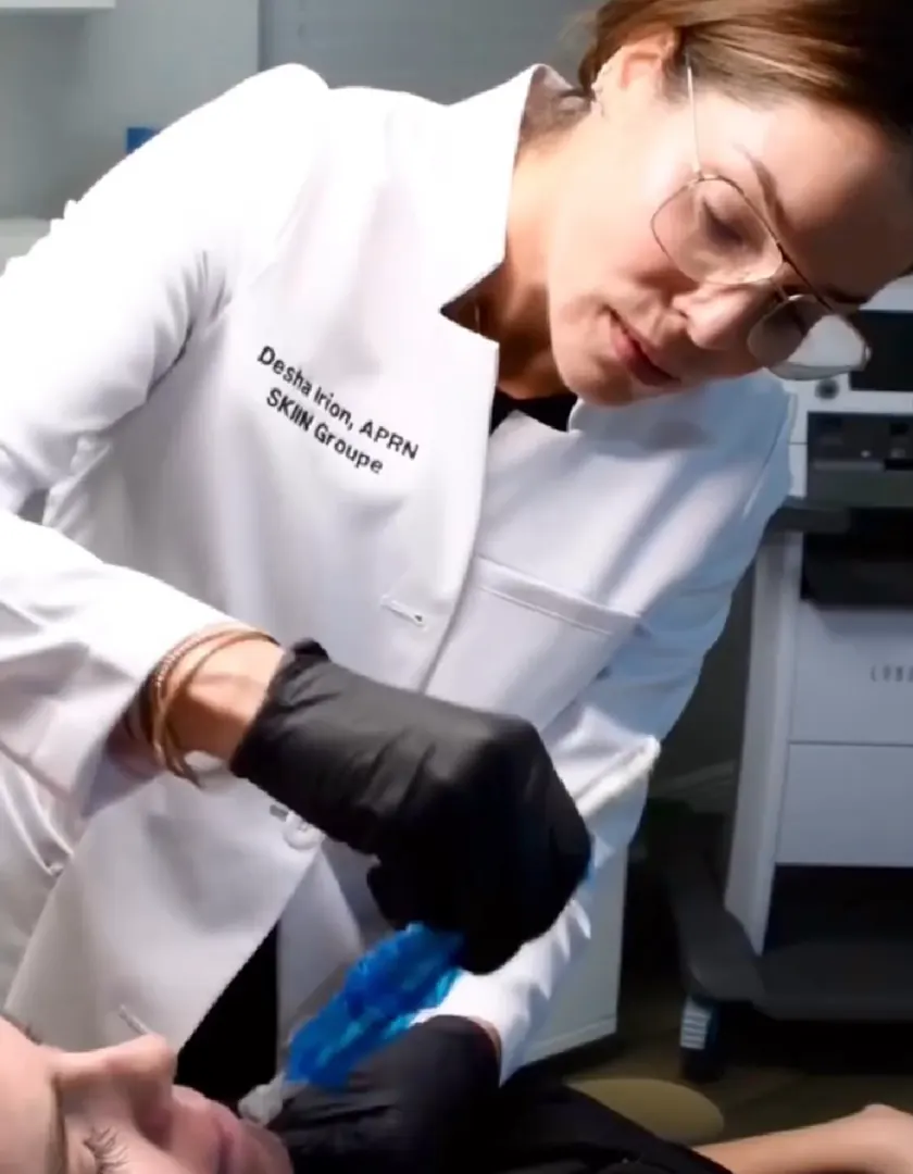 Desha Irion, APRN, performing a microneedling treatment on a patient at The SKIIN Groupe
